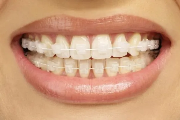 six month smiles (3) (1)