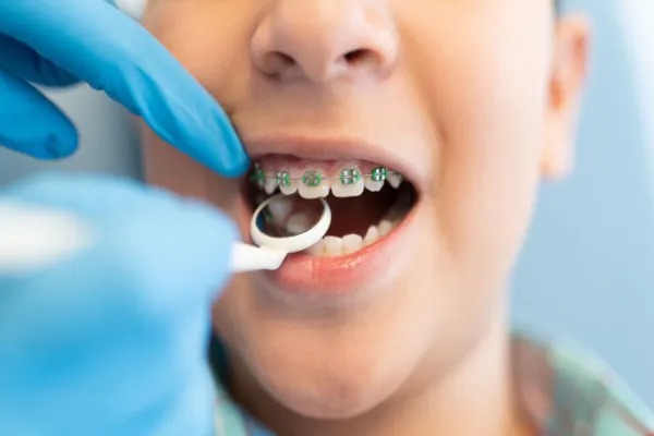 Children & Teen Orthodontics