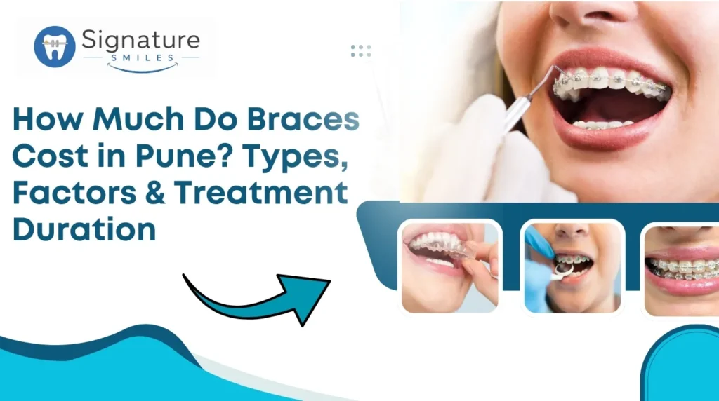 Braces Cost in Pune