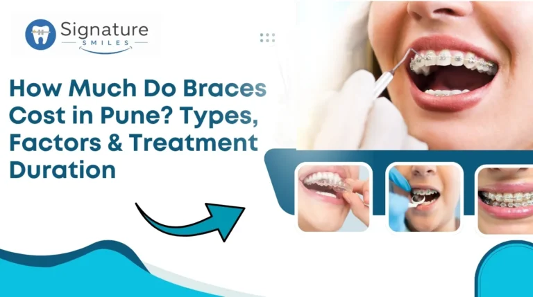 Braces Cost in Pune